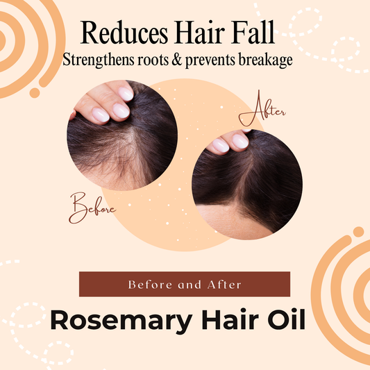 Rosemary Organic Hair Growth Oil