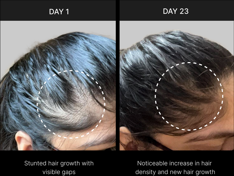Rice Shampoo, Conditioner & Rosemary Hair Oil Combo