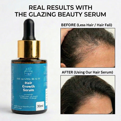 The Glazing Beauty Hair Regrowth Serum- 3% Redensyl, 4% Anagain & 3% Capilia Stem Cell Complex