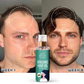 Organic Hair Growth Oil For Men and Women- Pack Of 2