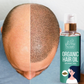 Organic Hair Growth Oil For Men and Women- Pack Of 2